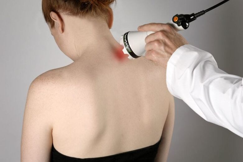 Traitement au laser de l'ostéochondrose cervicale chez la femme